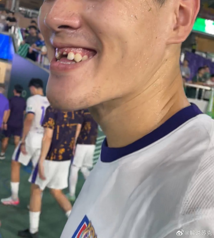記者：王獻均門牙留在了黃龍體育中心，很多人一起找都沒找到